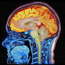 Brain in color